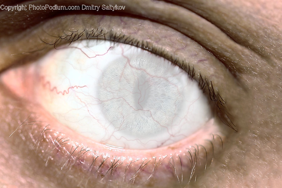 Contact Lens