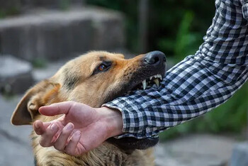 Choose the Trusted Dog Bite Attorney in Fort Worth
